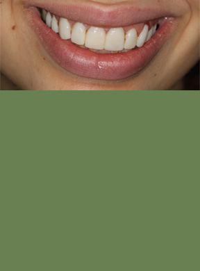 5 after